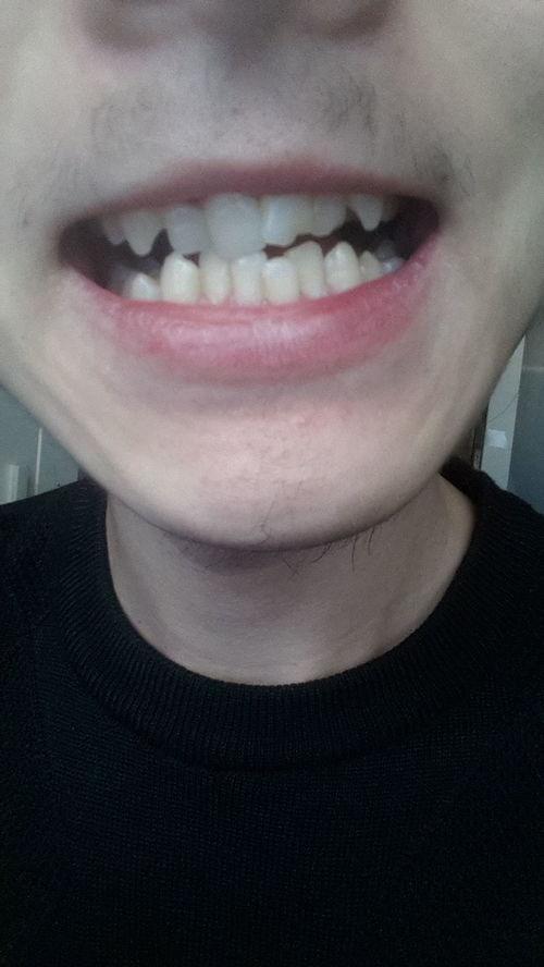 成人会长门牙嘛视频,视频深度解析